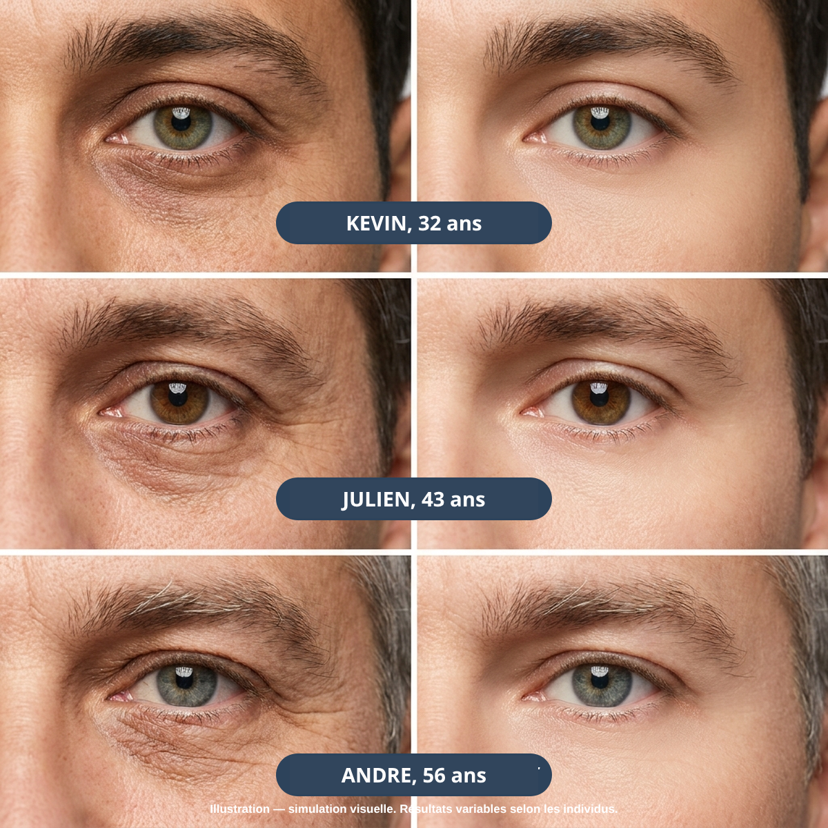 Patchs Micro-Aiguilles contour des yeux pour Homme