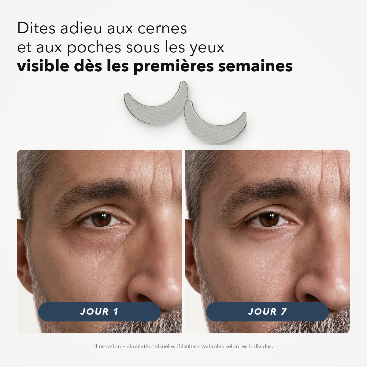 Patchs Micro-Aiguilles contour des yeux pour Homme