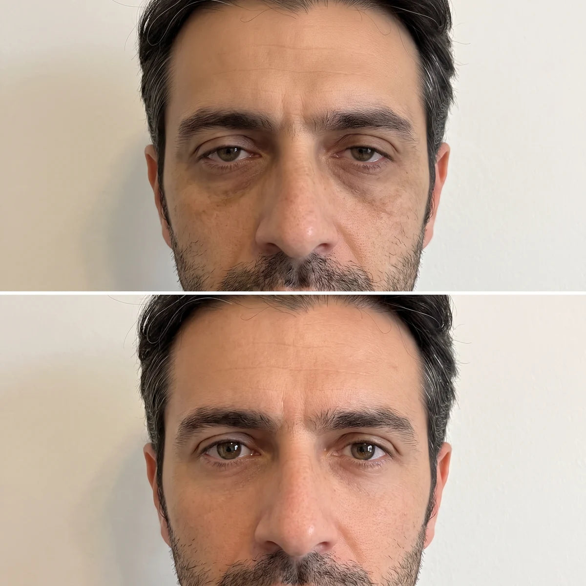 Avant et après : Thierry, 43 ans, visage fatigué puis visage reposé après la cure de gommes Sarveni